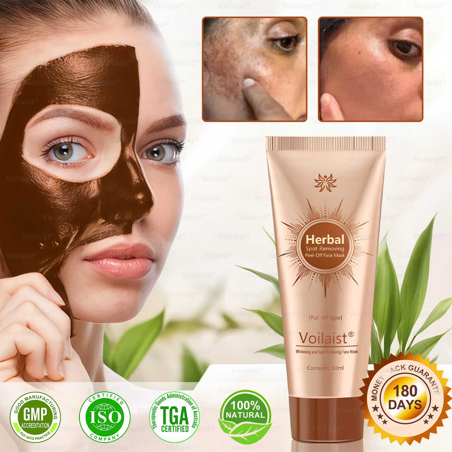 🏵️ Voilaist® Whitening and Spot-Removing Face Mask Suitable for face and body – 👩⚕️ Natural ingredients permanently remove age spots, freckles, sun spots, and liver spots.